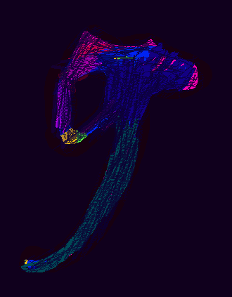 Medium 20150303203715