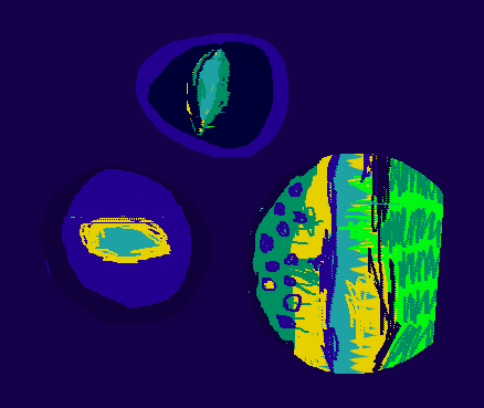 Medium 20150303205036