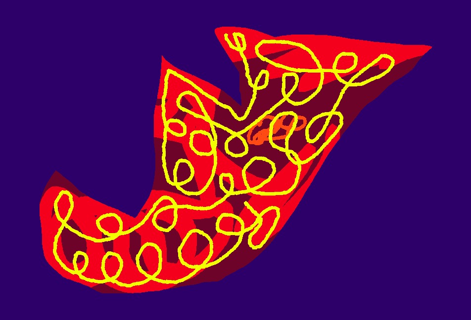 Medium 20150303211725