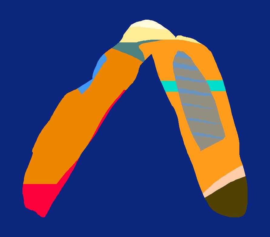 Medium 20150303212402