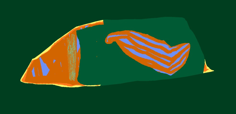 Medium 20150303221539