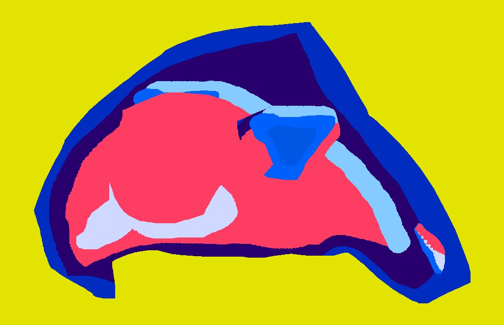 Medium 20150304000418