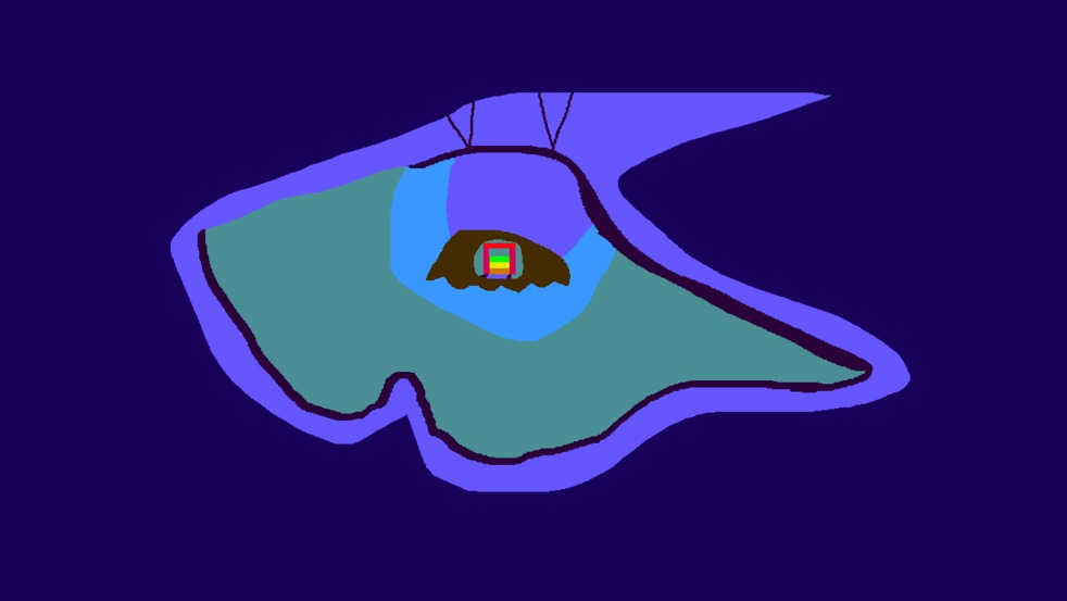 Medium 20150304000451