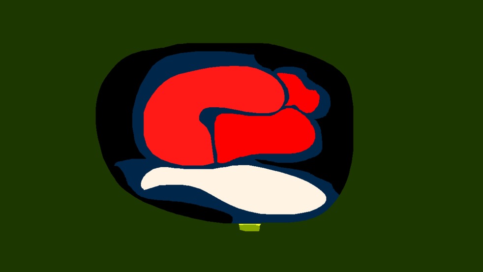 Medium 20150304000547