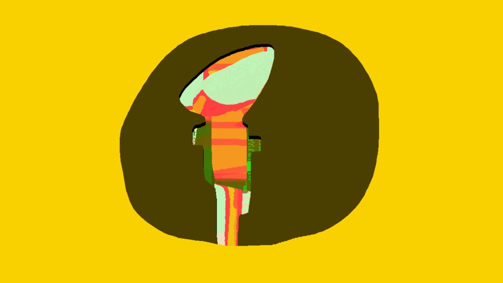 Medium 20150304000828