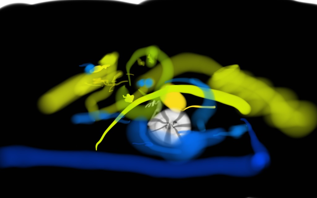 Medium 20150310142436